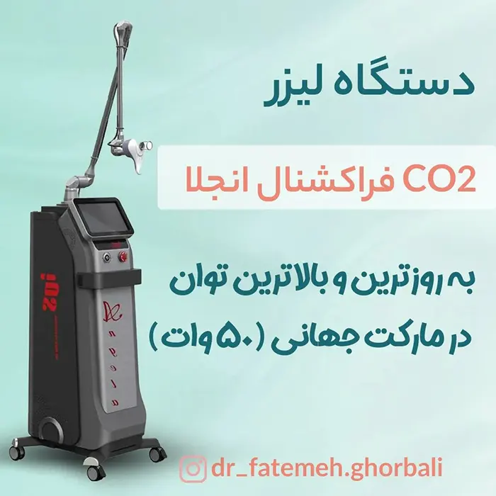 رفع تیرگی واژن با لیزر آنجلا